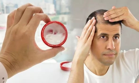 درمان ریزش مو با سیر