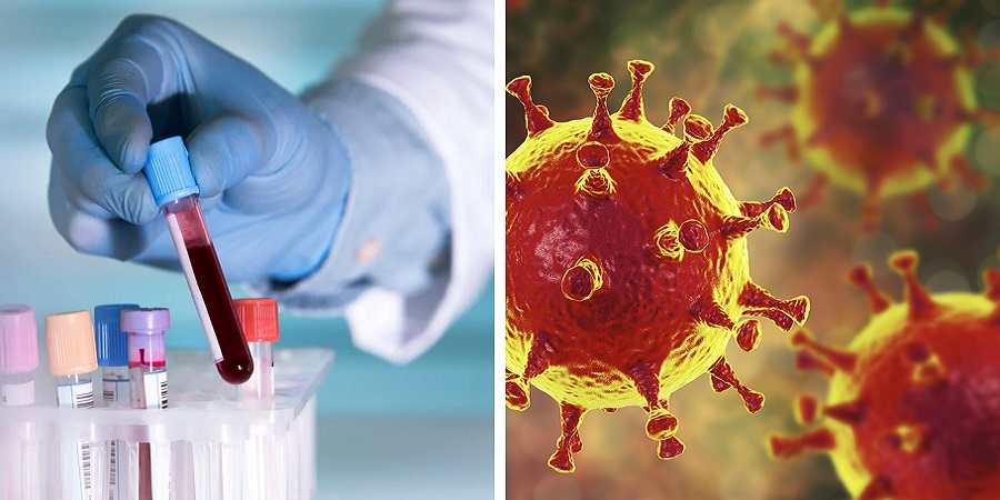چه ارتباطی میان گروه خونی و ابتلا به ویروس کرونا وجود دارد؟
