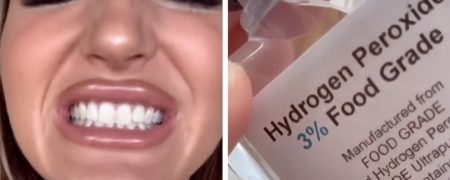 ترند جدید شبکه اجتماعی تیک تاک؛ سفید کردن دندان با وایتکس!