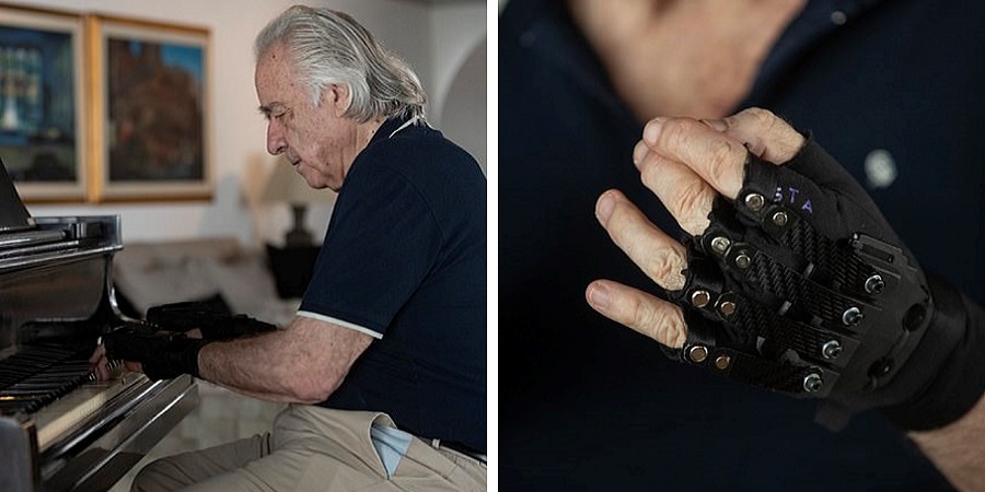 پیانو نوازی هنرمند بیمار بعد از ۲۰ سال به کمک دستکش های مصنوعی + ویدئو