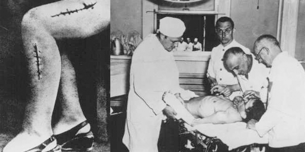 10 آزمایش هولناک و غیرانسانی پزشکان نازی آلمانی روی زندانیان [قسمت اول]