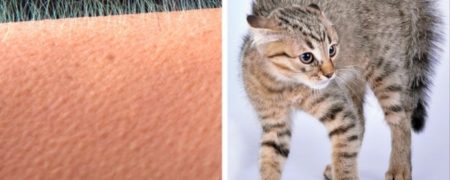 چند حقیقت جالب درباره پوست انسان که نمی دانستید