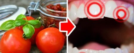 مضرترین مواد غذایی برای دندان ها کدام هستند؟