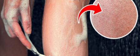 علت دون دون شدن پوست پا چیست و چطور می توان آن را برطرف کرد؟