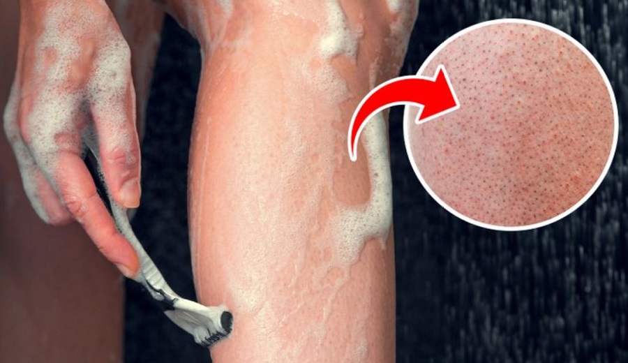 علت دون دون شدن پوست پا چیست و چطور می توان آن را برطرف کرد؟