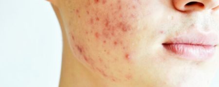 جوش و ۷ باور رایج اما نادرست درباره آن