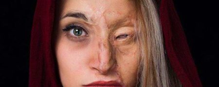 از «مرضیه» تا «سحر»: جزییات اسیدپاشی مرگبار دختر تهرانی روی پدرش