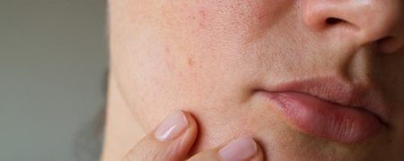 راهکارهایی برای کوچک کردن منافذ پوست