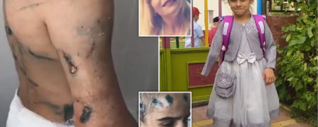 شکنجه‌های هولناک عمه شیطان‌صفت باعث قطع شدن دست دختر ۷ ساله شد + ویدیو
