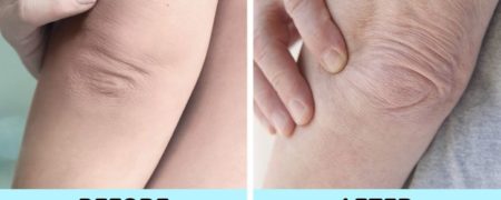 ۷ ناحیه بدن که نشانه های پیری را بهتر از هر نقطه دیگری هویدا می کنند