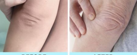 ۷ عضو بدن که سن واقعی تان را برملا می کنند