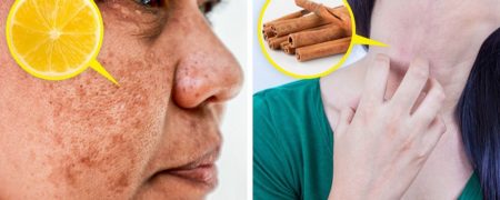 مضرات افراط در استفاده از مواد طبیعی در روتین مراقبت از پوست