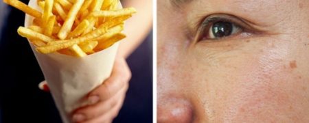 برای داشتن پوست بدون چین و چروک از این مواد غذایی پرهیز کنید