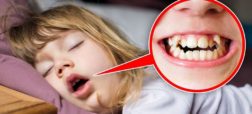 خوابیدن با دهان باز در کودکان چه مضراتی دارد؟