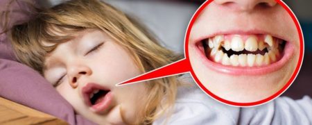 خوابیدن با دهان باز در کودکان چه مضراتی دارد؟