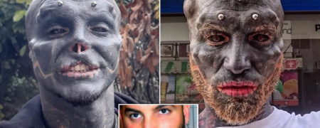 جوان فرانسوی که برای شباهت به موجودات فضایی گوش، بینی و لب خود را بریده است