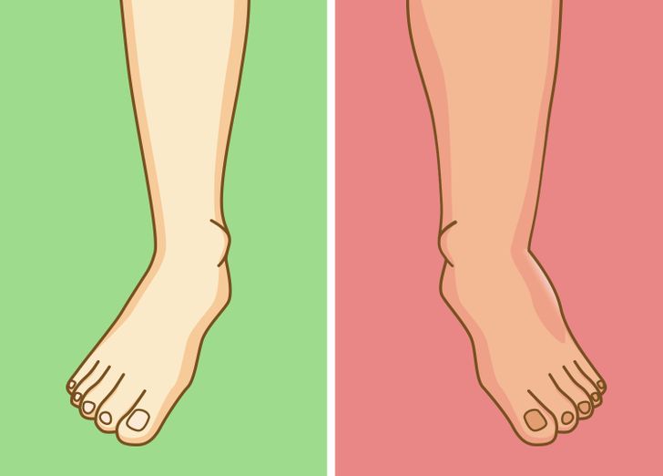 ۵ بلایی که عادت پا روی پا انداختن بر سر بدن می آورد