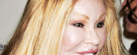 هنرپیشه هایی که با جراحی پلاستیک چهره خود را خراب کردند