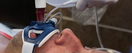 اینتوبه شدن چیست و چرا برای علی انصاریان انجام شد؟