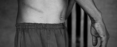 روستایی در نپال که ساکنان آن فقط یک کلیه دارند