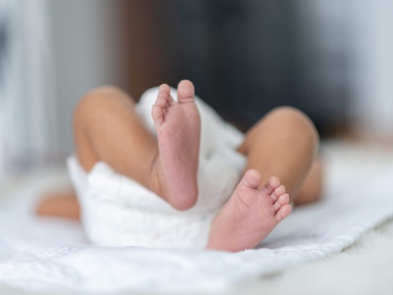پزشکان می گویند نوزادی که اخیراً در عراق با سه آلت تناسلی به دنیا آمده، اولین نوزاد در جهان است که با چنین شرایطی مشاهده شده است.
