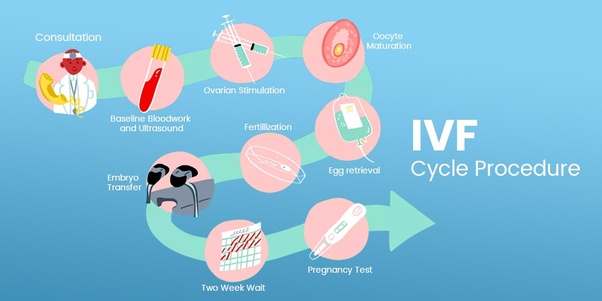 IVF چیست