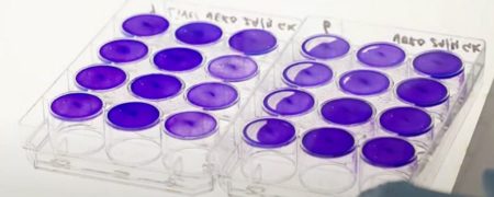 ابداع روش جدید درمان کرونا که ۹۹.۹ درصد ویروس‌ها در ریه فرد مبتلا را از بین می‌برد