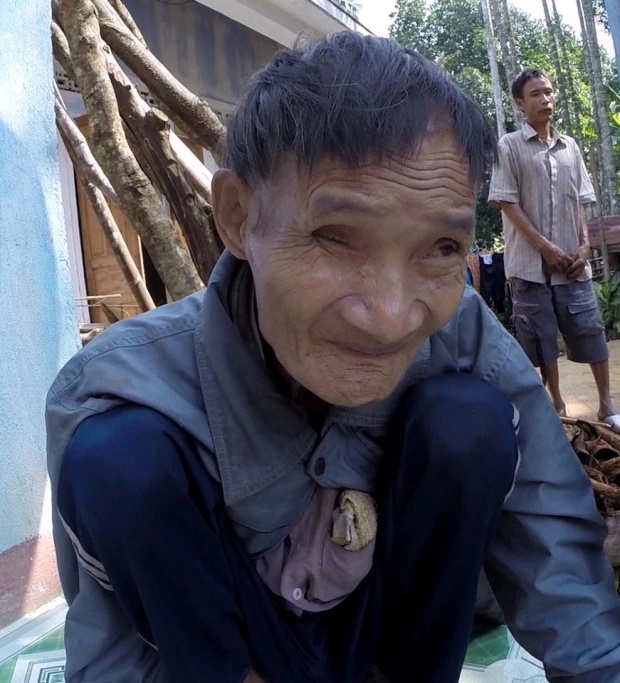 مرد 46 ساله ویتنامی ملقب به تارزان که سال ها در جنگل زندگی کرده، هیچ شناختی از زن ها نداشته و ذره ای میل جنسی در او دیده نمی شود