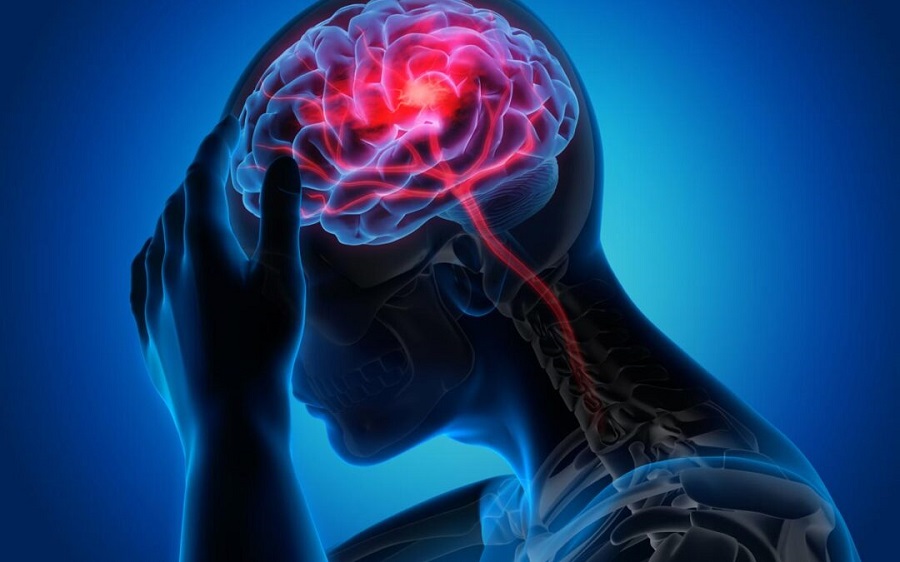 شیوع یک بیماری مغزی ناشناخته در کانادا با بیش از ۵۰ قربانی