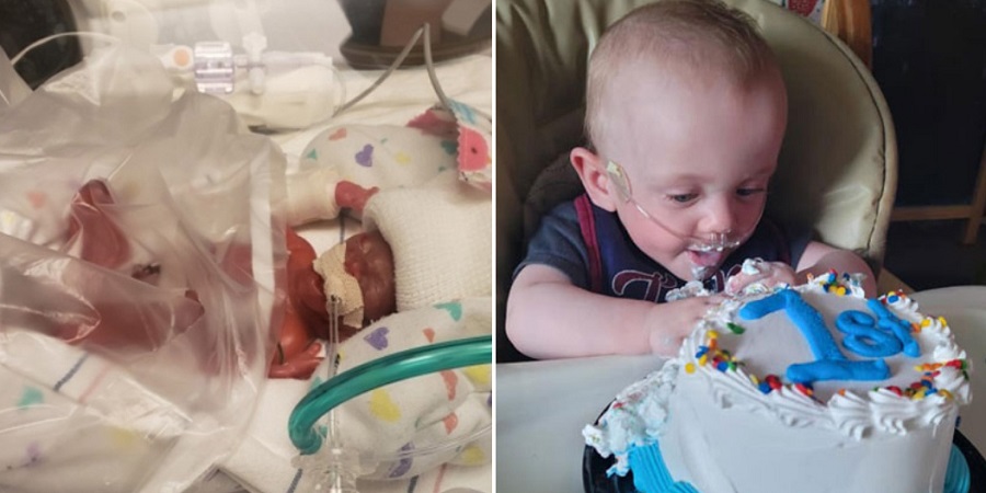 پیروزی جنگجوی کوچک؛ نارس ترین نوزاد دنیا تولد یک سالگی خود را جشن گرفت