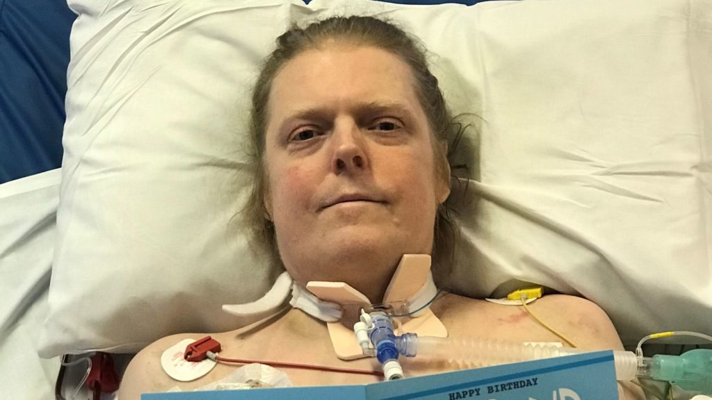 بیمار مبتلا به کرونا بعد از ۱۴ ماه جدال با مرگ درگذشت