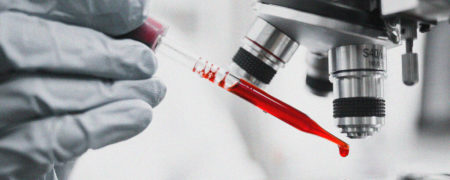 تست fbc چیست و چه بیماری هایی را آشکار می کند؟