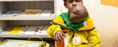 جدا کردن تومور غول پیکر از صورت دختربچه اتیوپیایی