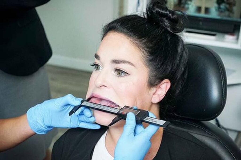 کاربر زن تیک تاکی رکورد گینس گشادترین دهان جهان را به نام خود ثبت کرد