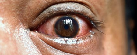 آیا قارچ سیاه به ایران هم رسیده است؟