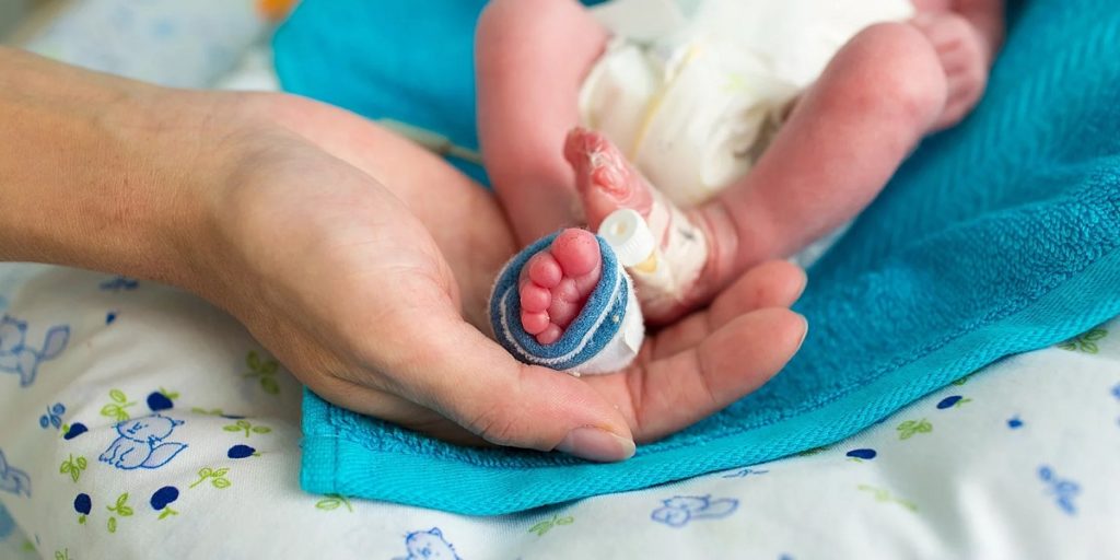 کوچک ترین نوزاد دنیا بعد از یک سال از بیمارستان مرخص شد