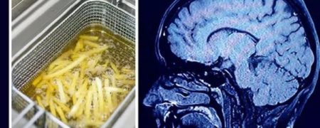 غذاهایی که برای دوری از آلزایمر باید از رژیم غذایی خود حذف کنید