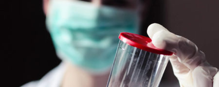 بافت برداری یا بیوپسی چیست؟ چه زمانی و چگونه انجام می‌شود؟