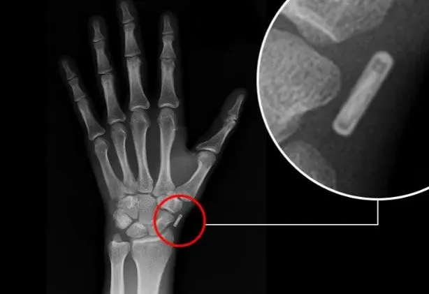 مردی که می گوید مسافر زمان از سال 2030 است مدعی شده که تصاویر اشعه ایکس می تواند ثابت کند که او دستگاهی در داخل دست خود دارد