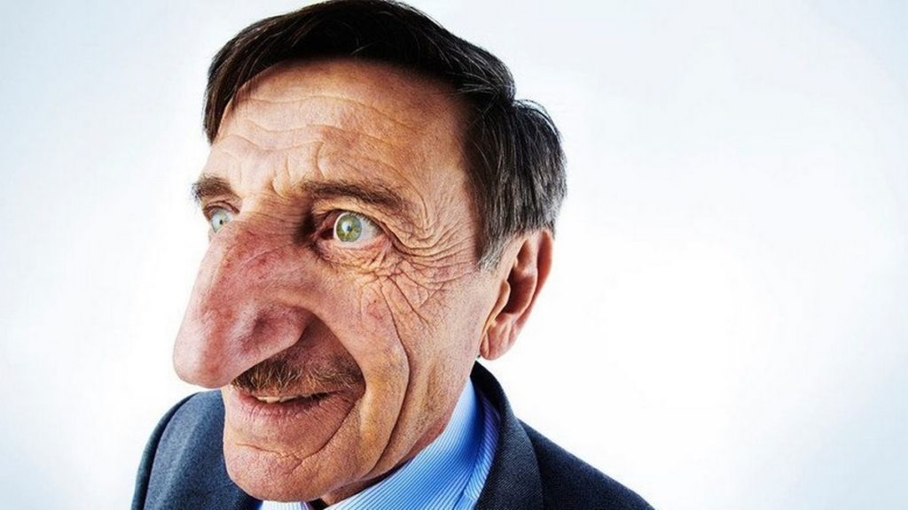 مرد ۷۱ ساله ترکیه ای همچنان صاحب بلندترین دماغ دنیا است