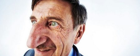 مرد ۷۱ ساله ترکیه ای همچنان صاحب بلندترین دماغ دنیا است