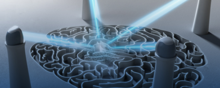 گامانایف آیکون؛ دقت بالا در درمان ضایعات مغزی