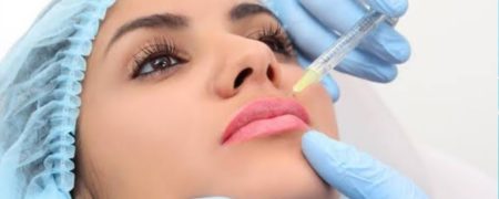 تزریق ژل لب برای چه افرادی مناسب است