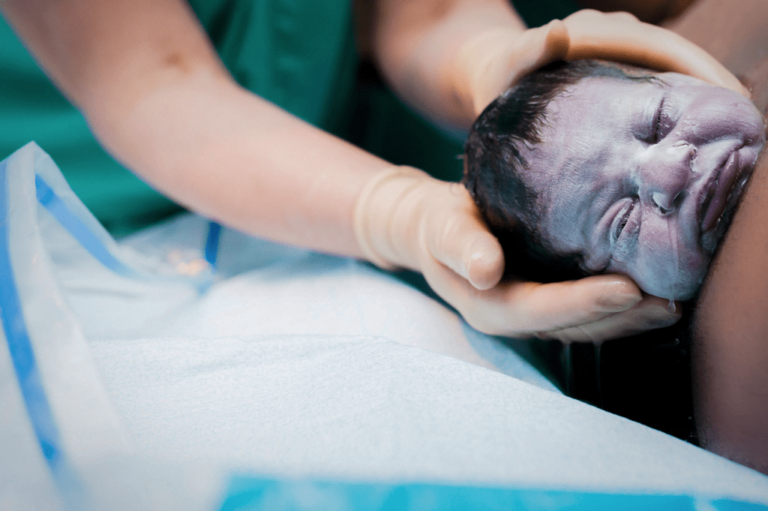 ۶ بلایی که زایمان با تولد فرزند بر سر واژن شما می‌آورد رهوا