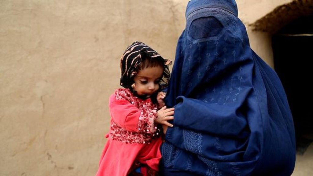 مادر افغان به خاطر فقر نوزادش را ۱۰۴ دلار فروخت