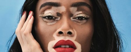 ۹ سلبریتی با ویژگی های جسمی منحصر به فرد