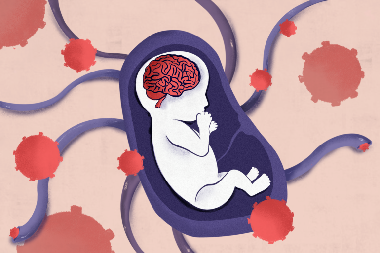 کرونا و بارداری : آیا ابتلا به کرونا در دوران بارداری به کودک شما آسیب می‌رساند؟