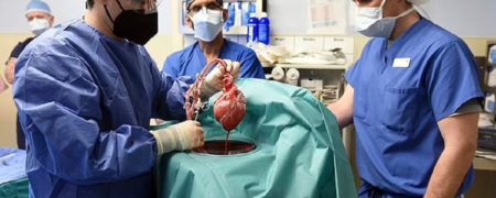 اولین پیوند قلب خوک به انسان با موفقیت در آمریکا انجام شد + ویدیو
