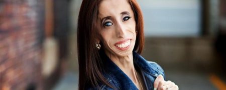 زشت ترین زن دنیا