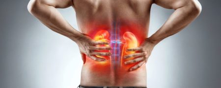 همه چیز در مورد بیماری کلیه پلی‌کیستیک؛ از علل ابتلا، علائم و عوارض تا پیشگیری و درمان